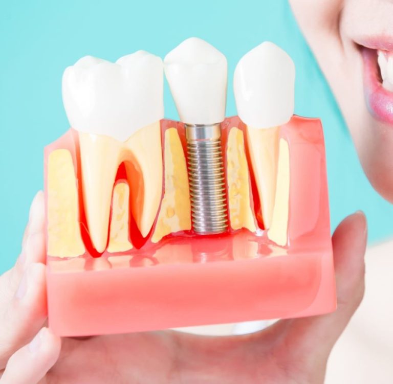 Pronto Soccorso Dentistico: Hai Mal Di Denti? Ecco La Soluzione - Foto 2